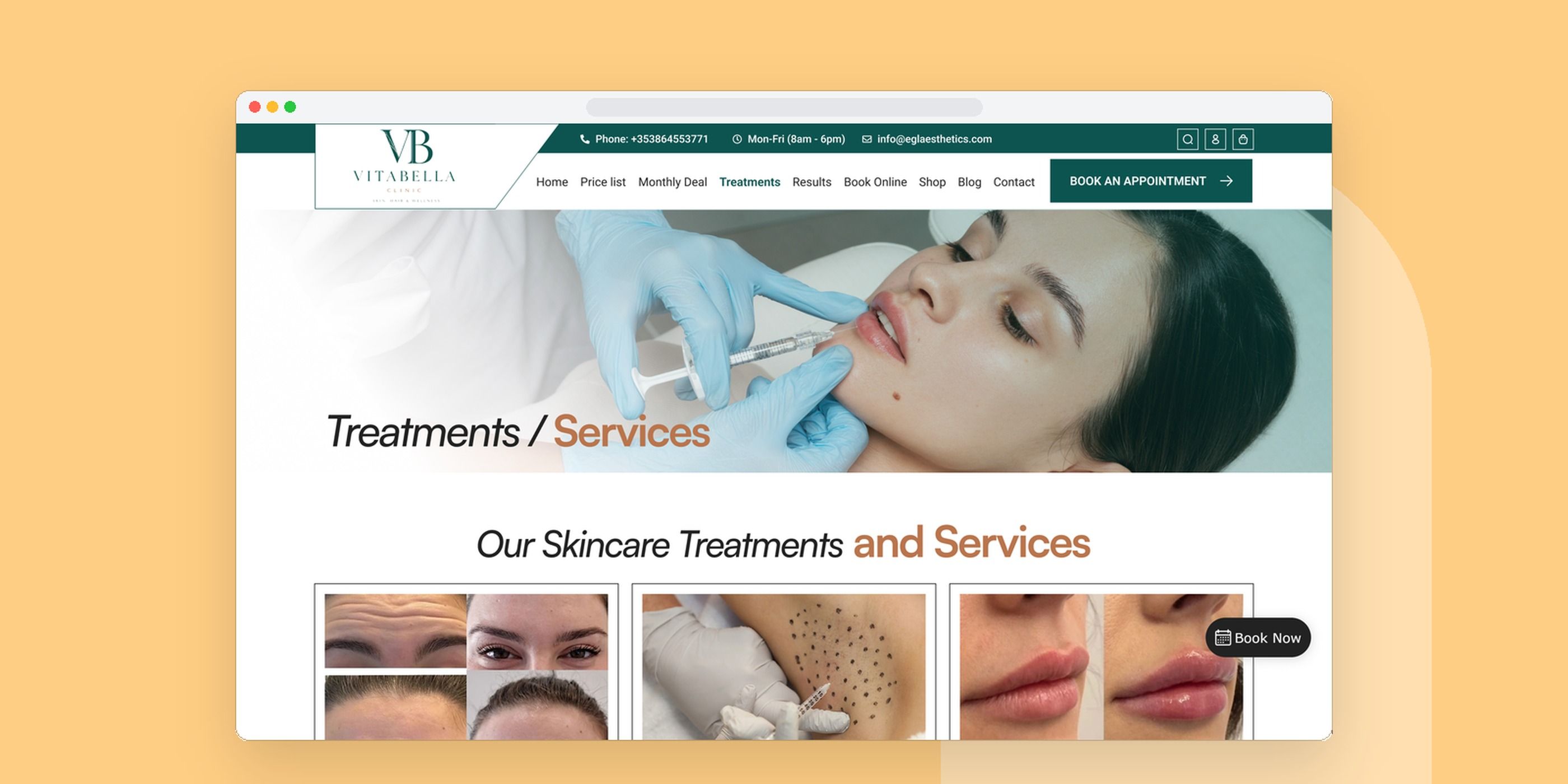 EGL AESTHETIC project by Codeeo
